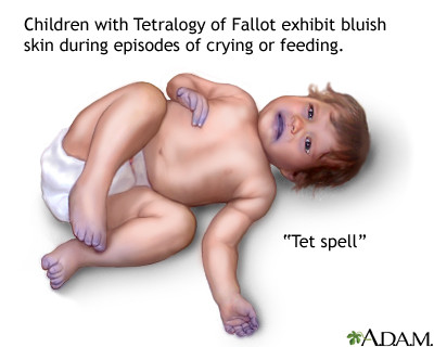 Spell Hypoxic