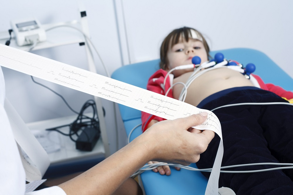 Fibrilasi Atrial Pada Anak