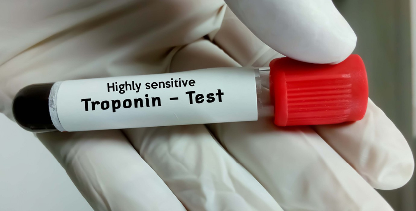 Troponin I