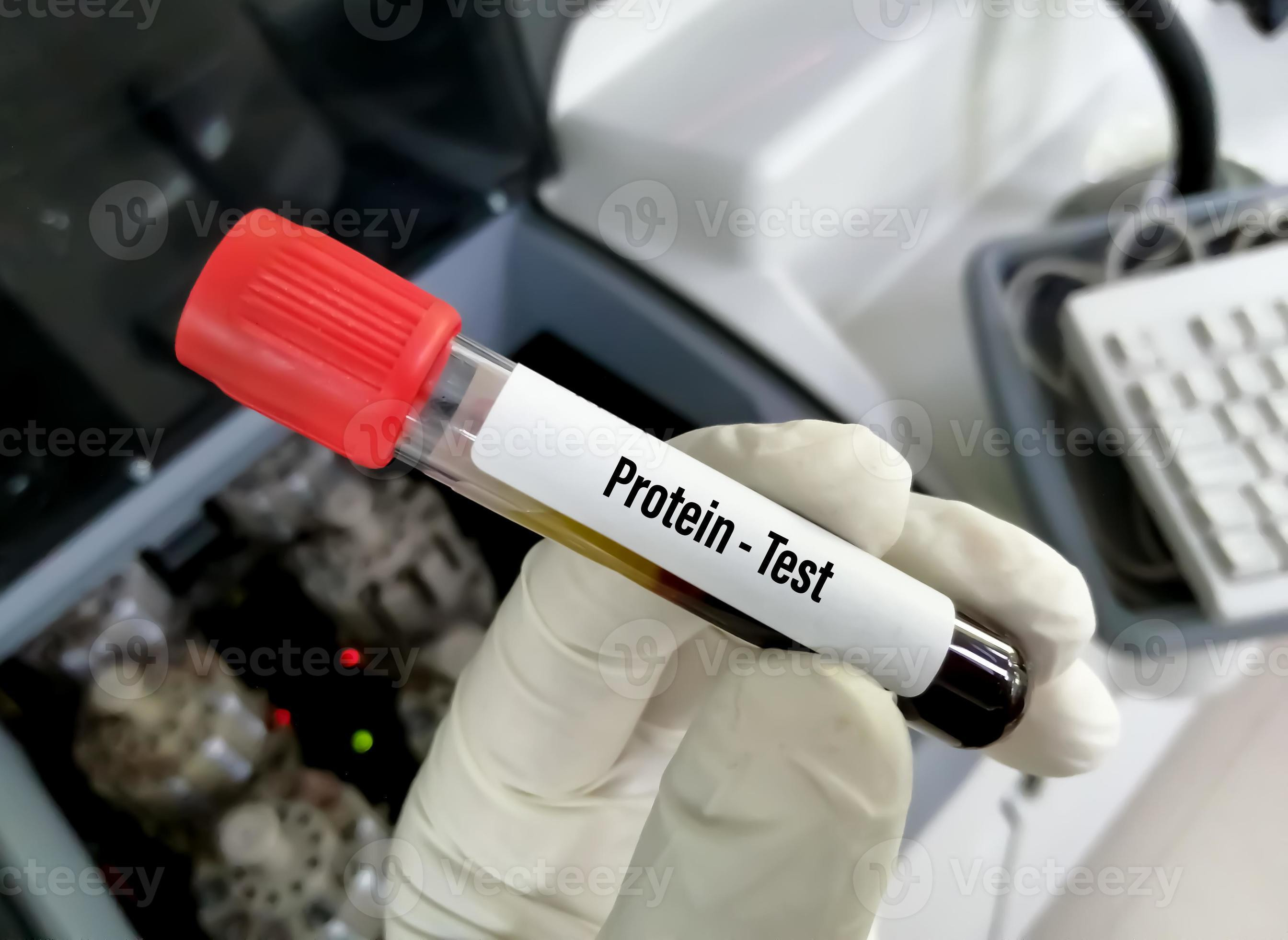 Protein total