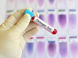 Pemeriksaan Fibrinogen