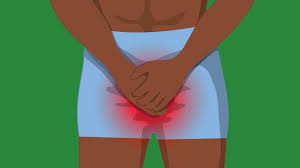 Balanitis