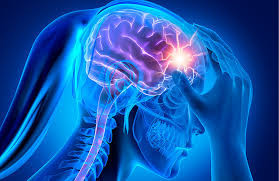 Status Migrainosus