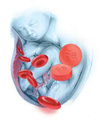 Anemia pada Kehamilan
