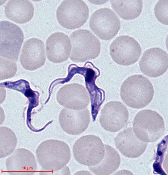 Leishmaniasis dan Tripanosomiasis