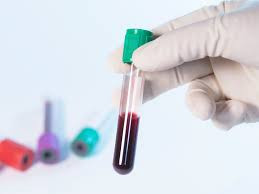 Anti-Rubella IgM