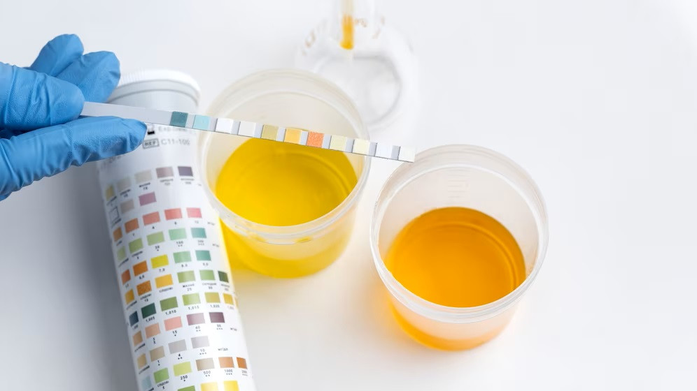 Urine dan Air Ketuban, Bagaimana Membedakannya?