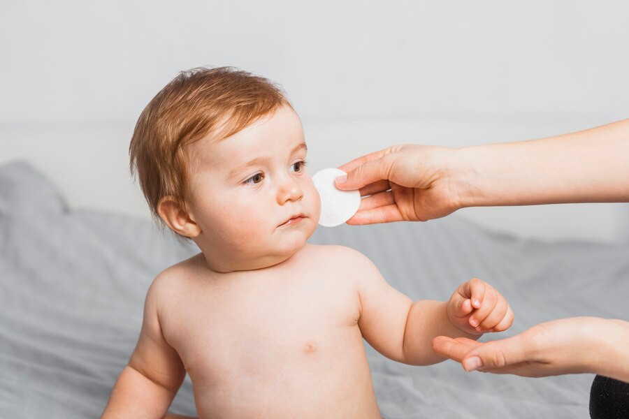 Gejala Skabies (Kudis) pada Bayi dan Anak-Anak Serta Pengobatannya