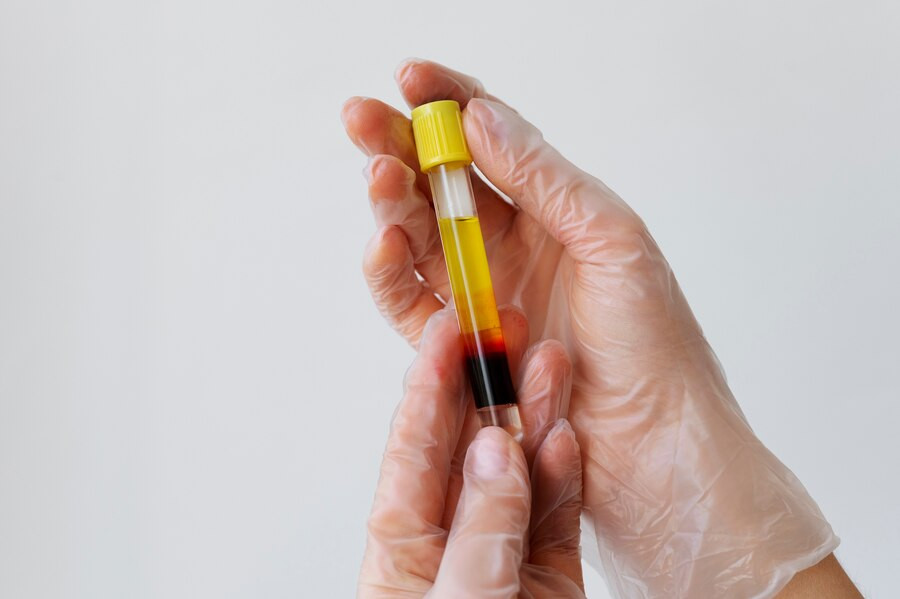 Mengapa Penting Melakukan Tes Kadar Vitamin D Sebelum Mengonsumsi Suplemennya?