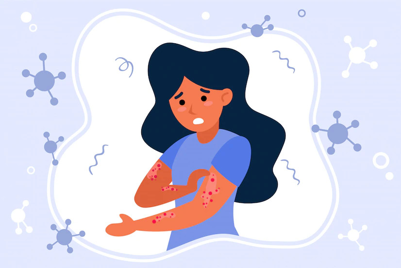 Disebabkan Virus yang Sama, Ini Bedanya Cacar Air dan Cacar Ular