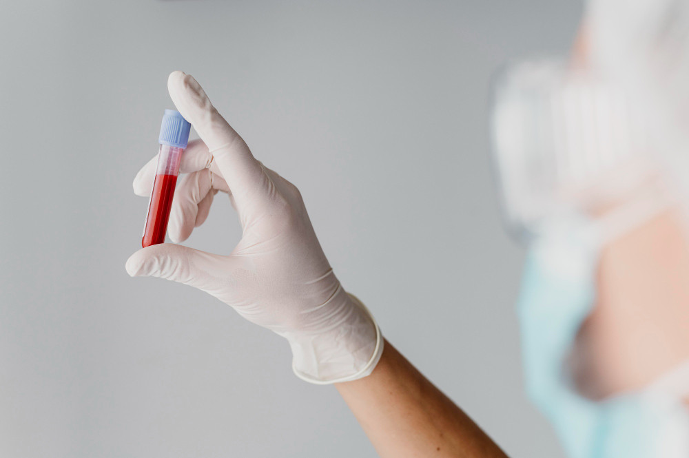 Ketahui Penyebab Hemoglobin (Hb) Rendah dan Cara Mengatasinya