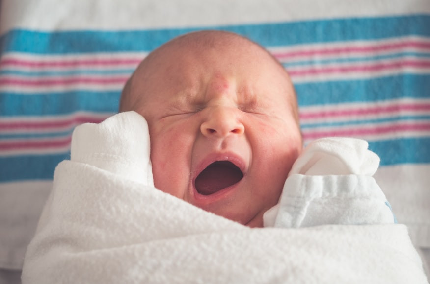 Penyebab Jerawat Bayi dan Cara Mengatasinya